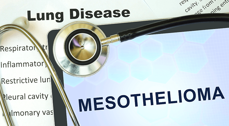 Receiving a mesothelioma diagnosis is devastating. iStock.com/designer491